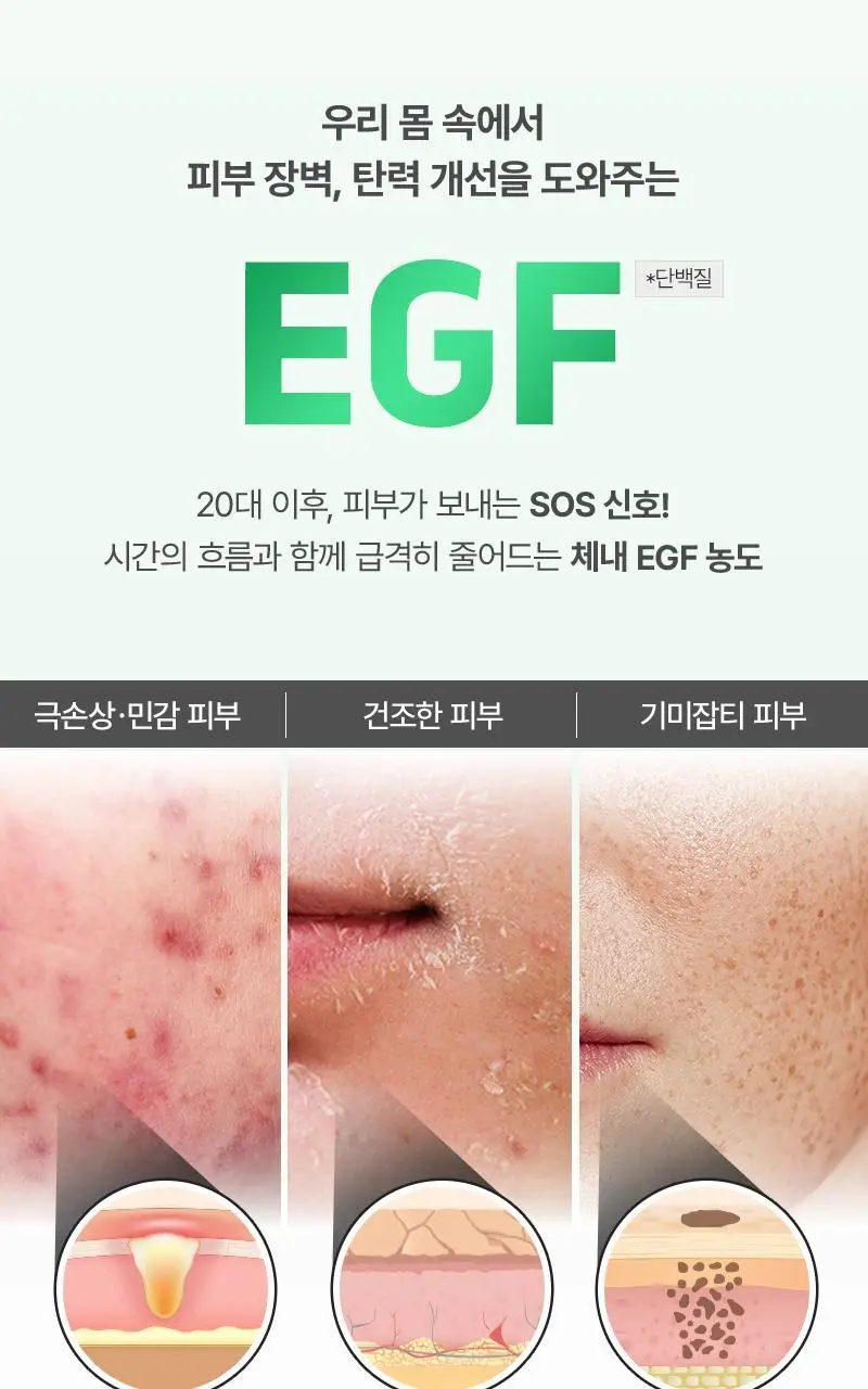 [장벽탄력/트러블] 지피덤 셀트리온EGF 스킨베리어 인텐시브 크림 80ml 상세페이지 13